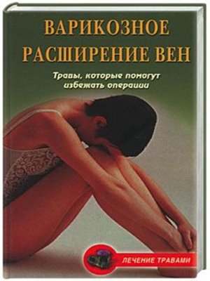 cover image of Варикозное расширение вен. Травы, которые помогут избежать операции